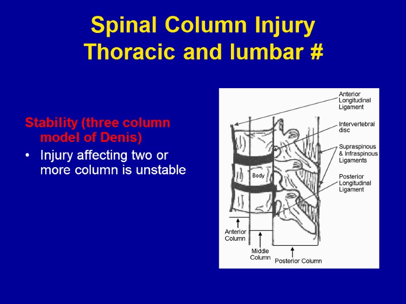 Spinal Column Injury Thoracic and lumbar # Stability (three column model of Denis) Injury